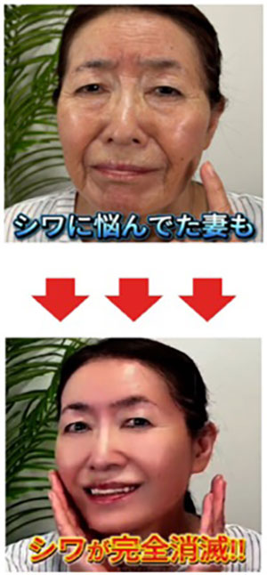 消費者庁が美容クリーム3社を特商法で処分、誇大広告と誤認表示で